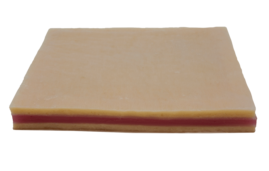 Abdominal Tissue Plate